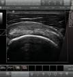 ultrasound2.jpg