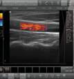 ultrasound3.jpg